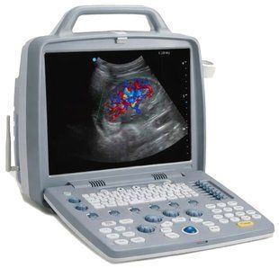 фото Ультразвуковий ветеринарний сканер Apogee 1200V 0105-0074 УкрВет