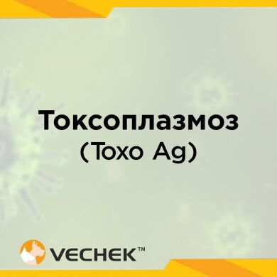 Экспресс-тест на токсоплазмоз (Toxo Ag),  VITO-602